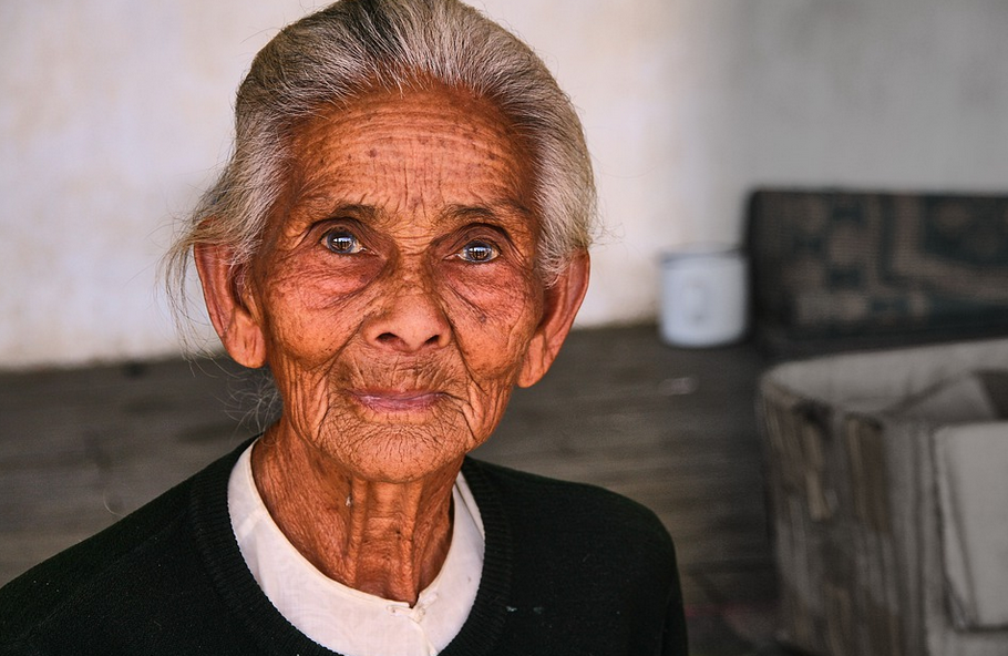 Tips to Remove Skin Tags